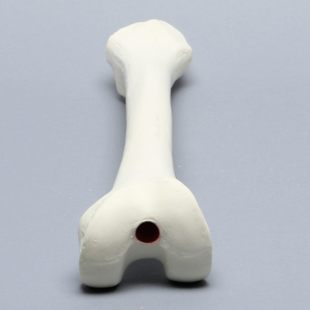 Femur with Broached Proximal Cavity