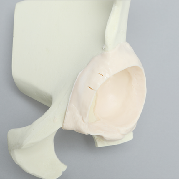 Hip Insert for Express Arthroscopy Hip