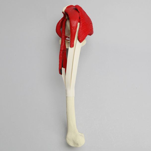 Hemi Pelvis with Erosion, Muscles, and Torn Labrum