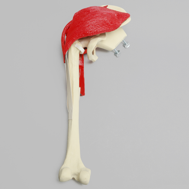 Hemi Pelvis with Erosion, Muscles, and Torn Labrum