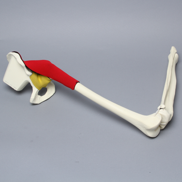 Hemi Pelvis, Encapsulated with Full Knee with Stretch Ligaments