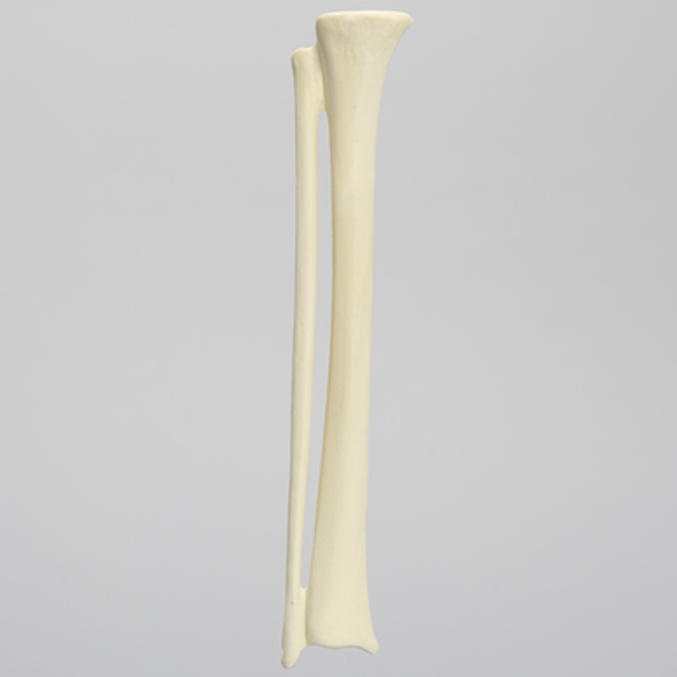 Tibia Fibula Combination
