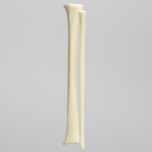 Tibia Fibula Combination