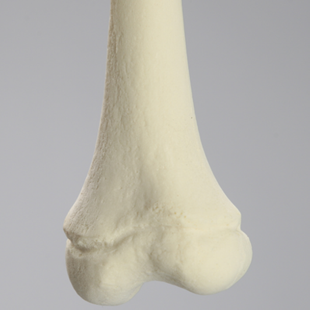 Femur, Pediatric, Solid Foam Light Density, Left