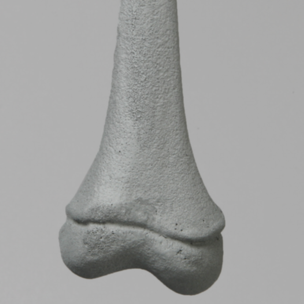 Femur, Pediatric with Radiopaque, Right