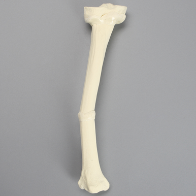 Tibia with Double Level Angulation