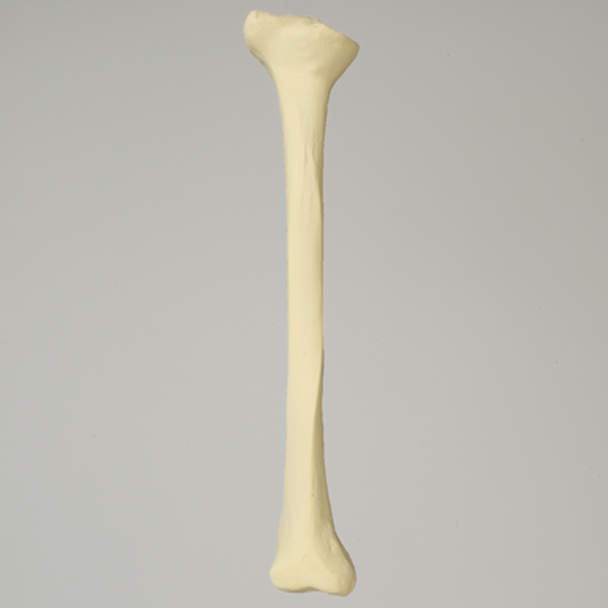 Tibia with Proximal and Distal Deformity