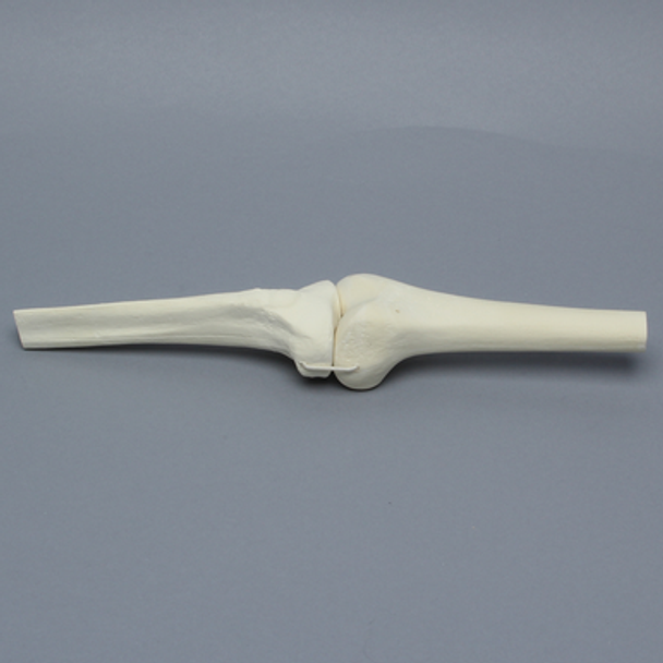 Knee Joint with Stretch Cord Collateral Ligaments and ACL Guide Holes, Solid Foam