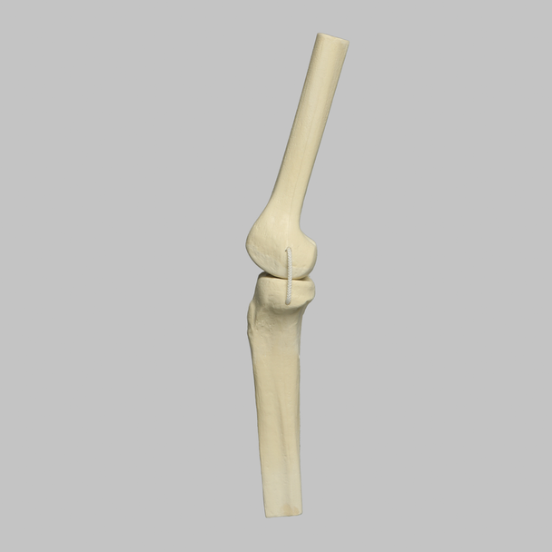 Knee Joint with Four Non-Stretch Ligaments, Solid Foam, Medium