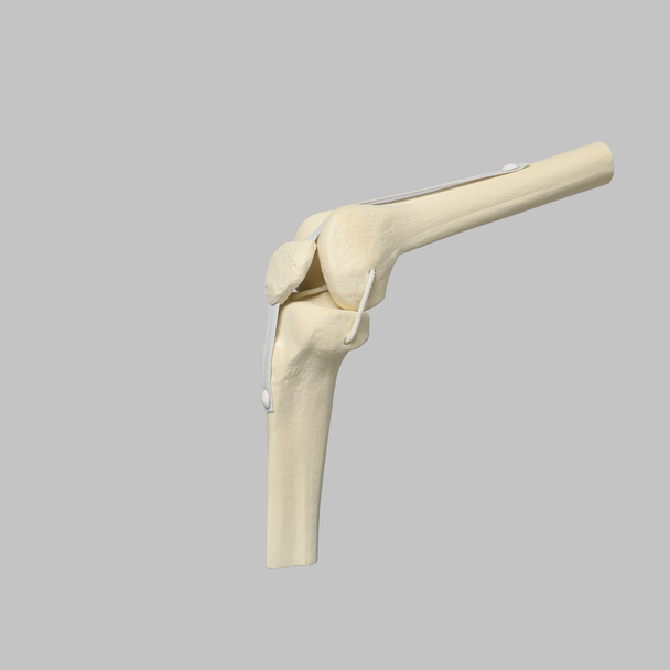 Knee Joint with Patella and Four Non-Stretch Ligaments, Solid Foam, Medium