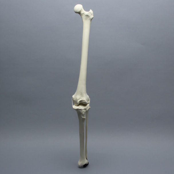 Knee with Fibula and Three Stretch Cord Ligaments, Full Length, Arthritic