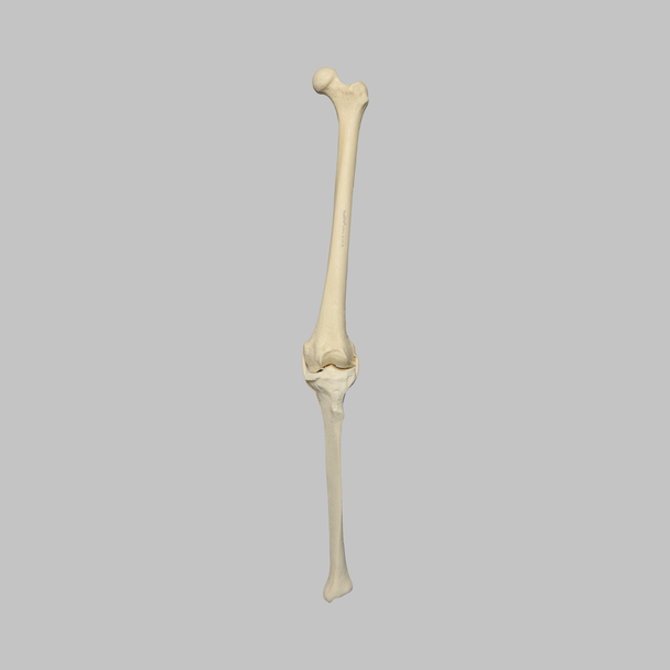 Knee with Three Stretch Tube Ligaments, Full Length, Arthritic