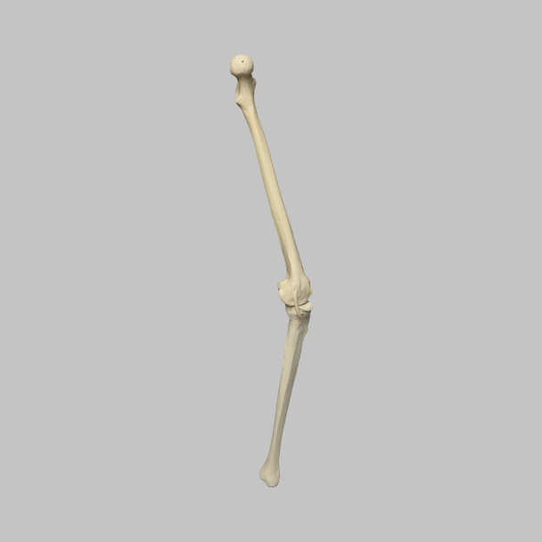 Knee with Three Stretch Tube Ligaments, Full Length, Arthritic