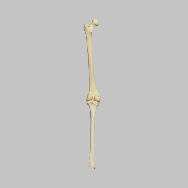 Knee with Three Stretch Tube Ligaments, Full Length, Arthritic