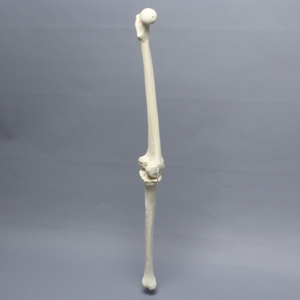 Knee with Four Non-Stretch Ligaments, Full Length, Arthritic