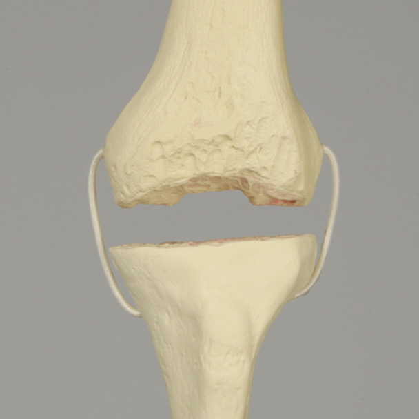 Knee with Revision Cuts and Stretch Cord Collateral Ligaments, Full Length