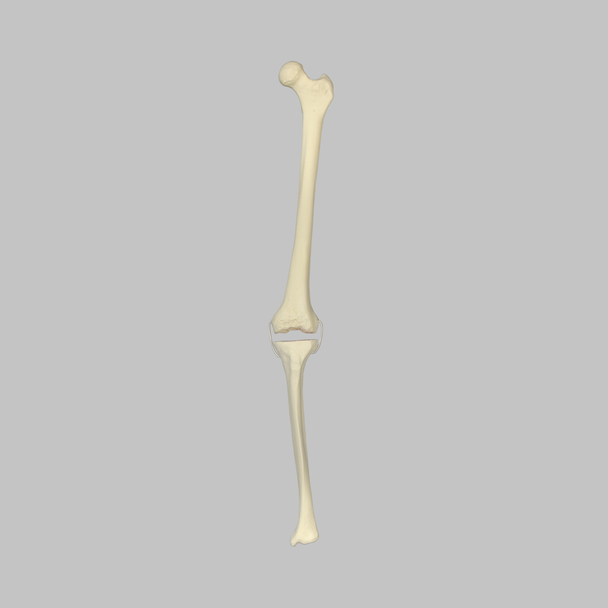 Knee with Revision Cuts and Stretch Cord Collateral Ligaments, Full Length