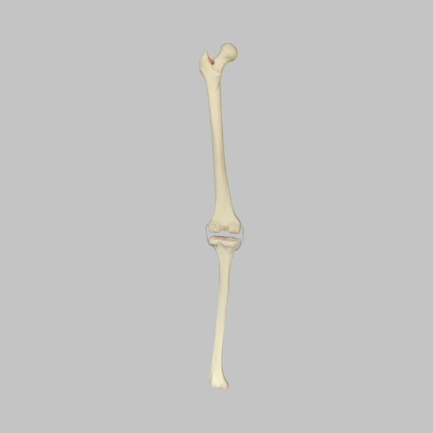 Knee with Revision Cuts and Stretch Cord Collateral Ligaments, Full Length