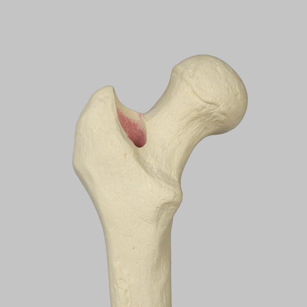 Knee with Revision Cuts and Stretch Cord Collateral Ligaments, Full Length