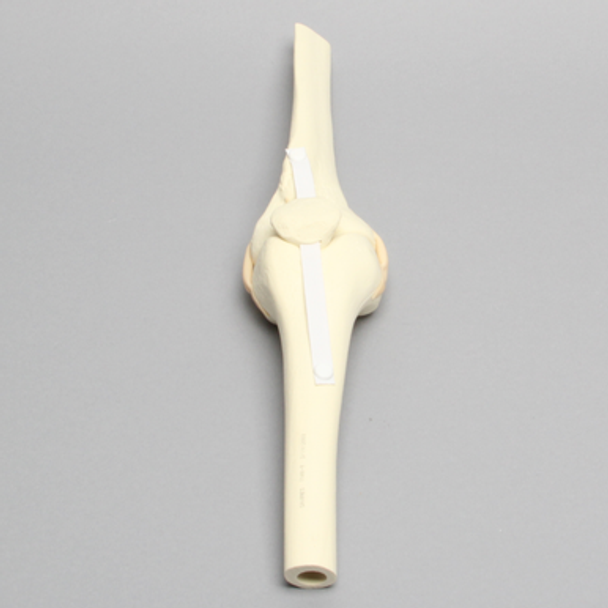 Knee Joint with Patella, Narrow Intercondylar Notch, and Four Stretch Tube Ligaments