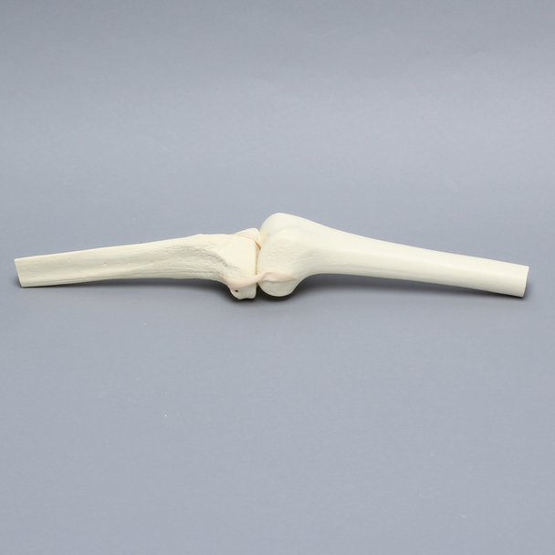 Knee Joint with Narrow Intercondylar Notch and Four Stretch Tube Ligaments