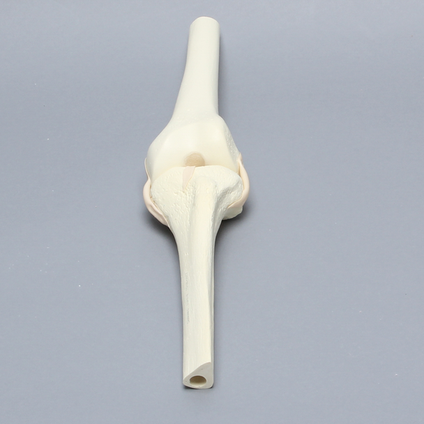 Knee Joint with Narrow Intercondylar Notch and Four Stretch Tube Ligaments