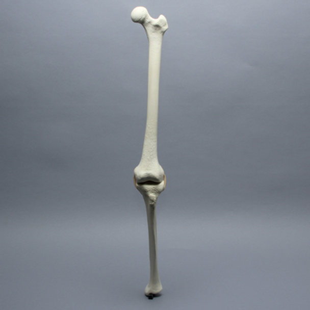 Knee with Three Stretch Tube Ligaments and Thicker Cortex, Full Length