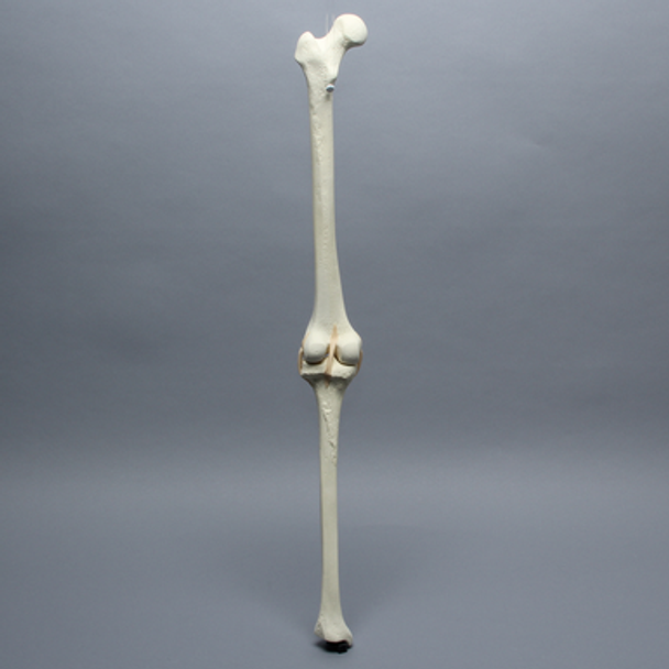 Knee with Three Stretch Tube Ligaments and Thicker Cortex, Full Length