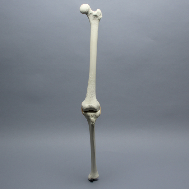 Knee with Three Stretch Tube Ligaments and Thicker Cortex, Full Length