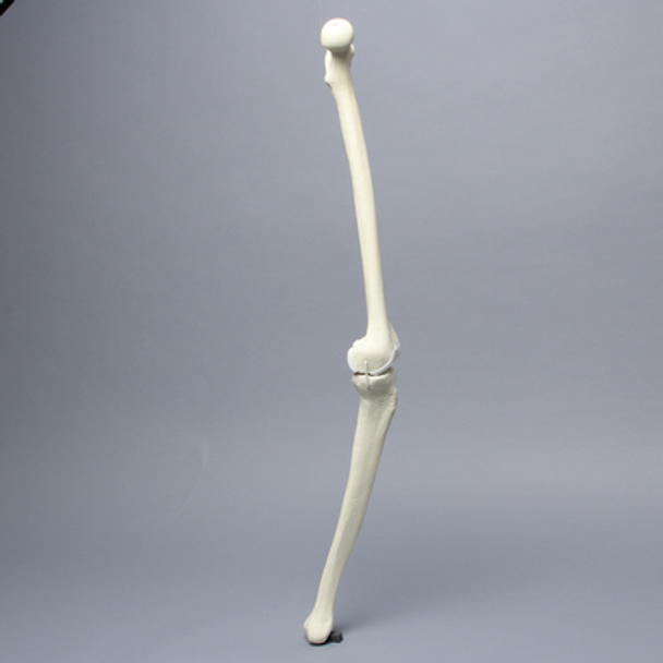 Knee with Erosion and Three Stretch Cord Ligaments, Full Length