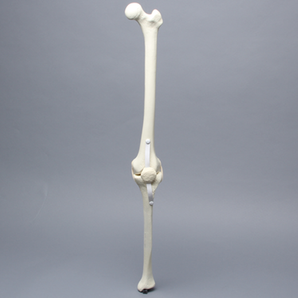 Knee with Patella, Narrow Intercondylar Notch, and Three Stretch Tube Ligaments, Full Length