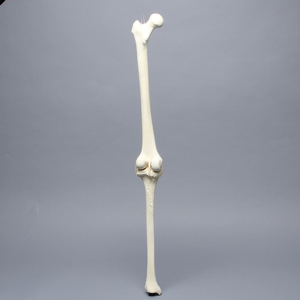 Knee with Patella, Narrow Intercondylar Notch, and Three Stretch Tube Ligaments, Full Length