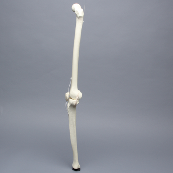 Knee with Patella, Narrow Intercondylar Notch, and Three Stretch Tube Ligaments, Full Length