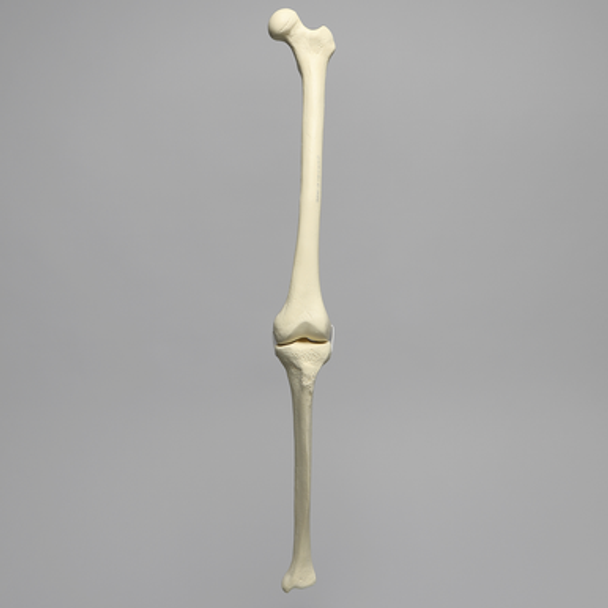 Knee with Three Stretch Cord Ligaments and Narrow Intercondylar Notch, Full Length