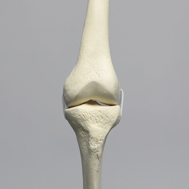 Knee with Three Stretch Cord Ligaments and Narrow Intercondylar Notch, Full Length