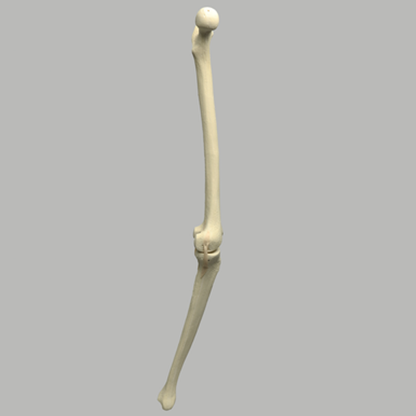 Knee with Three Stretch Tube Ligaments and Narrow Intercondylar Notch, Full Length, Left