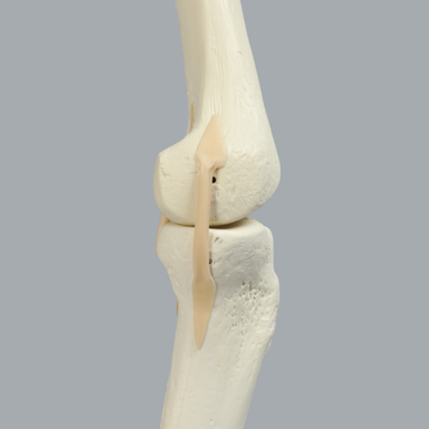 Knee with Three Stretch Tube Ligaments and Narrow Intercondylar Notch, Full Length, Left
