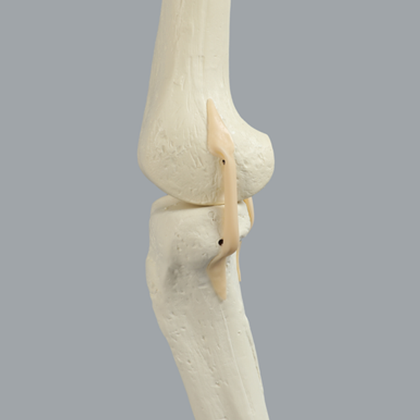Knee with Three Stretch Tube Ligaments and Narrow Intercondylar Notch, Full Length, Left