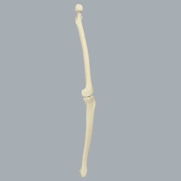 Knee with Three Nylon Non-Stretch Ligaments and Narrow Intercondylar Notch, Full Length