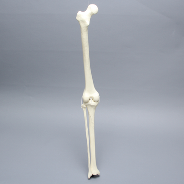 Knee with Fibula, Narrow Intercondylar Notch, and Four Stretch Ligaments, Full Length
