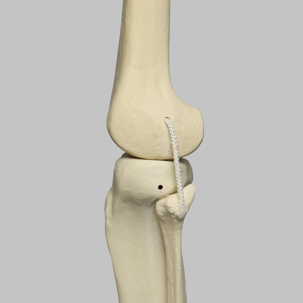 Knee with Fibula, Narrow Intercondylar Notch, and Four Non-Stretch Ligaments, Full Length