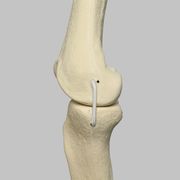 Knee with Four Stretch Cord Ligaments, Solid Foam, Right