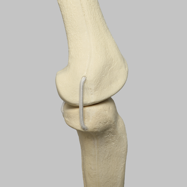 Knee with Four Stretch Cord Ligaments, Solid Foam, Right