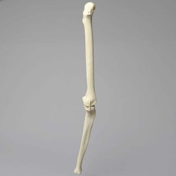 Knee with Three Stretch Tube Ligaments, Solid Foam, Right