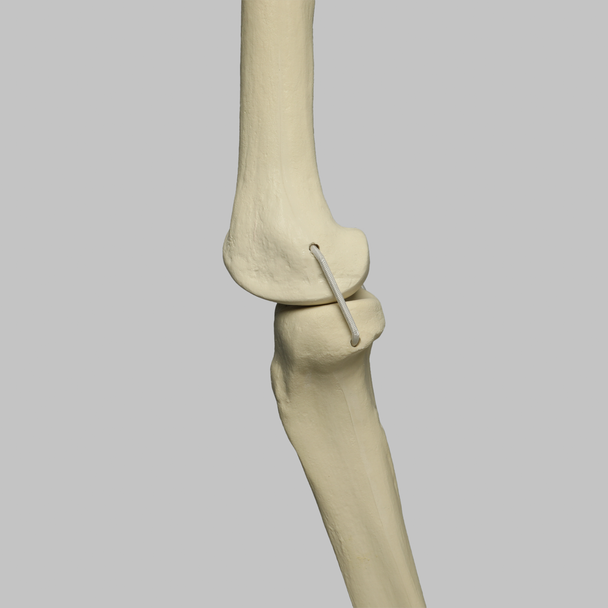 Knee with Four Stretch Cord Ligaments, Solid Foam, Full Length
