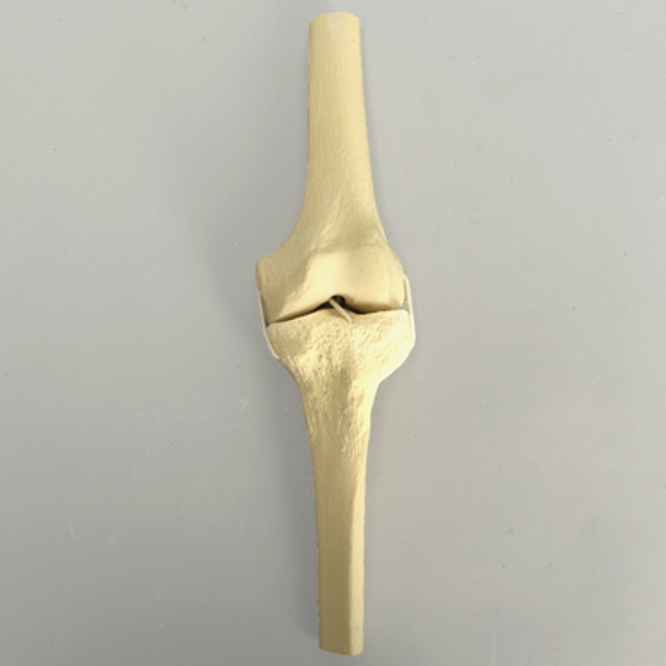 Knee with Four Stretch Cord Ligaments, Half Length