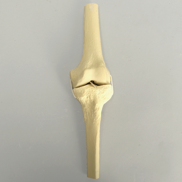 Knee with Four Stretch Cord Ligaments, Half Length
