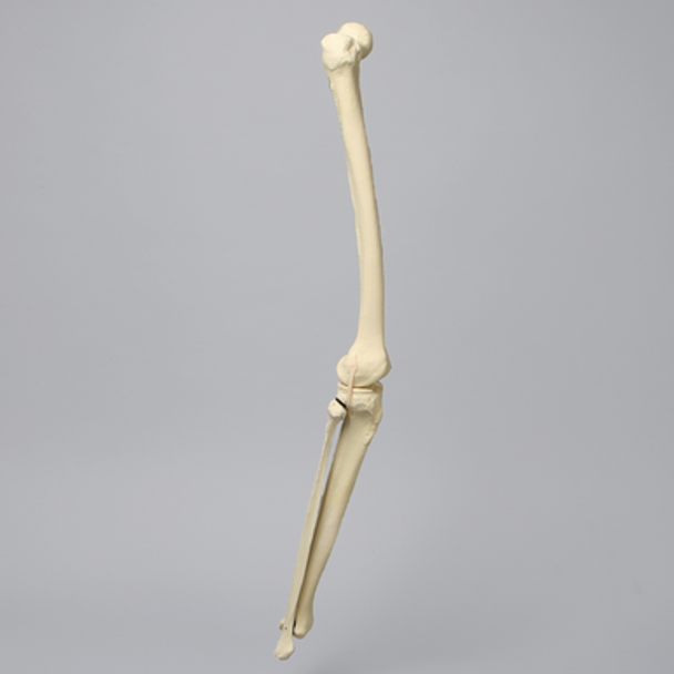 Knee with Fibula and Three Stretch Ligaments, Full Length