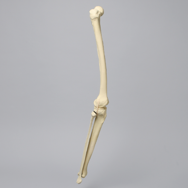 Knee with Fibula and Three Stretch Ligaments, Full Length