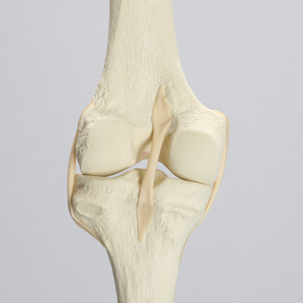 Knee with Three Stretch Tube Ligaments and Narrow Femoral Canal, Full Length